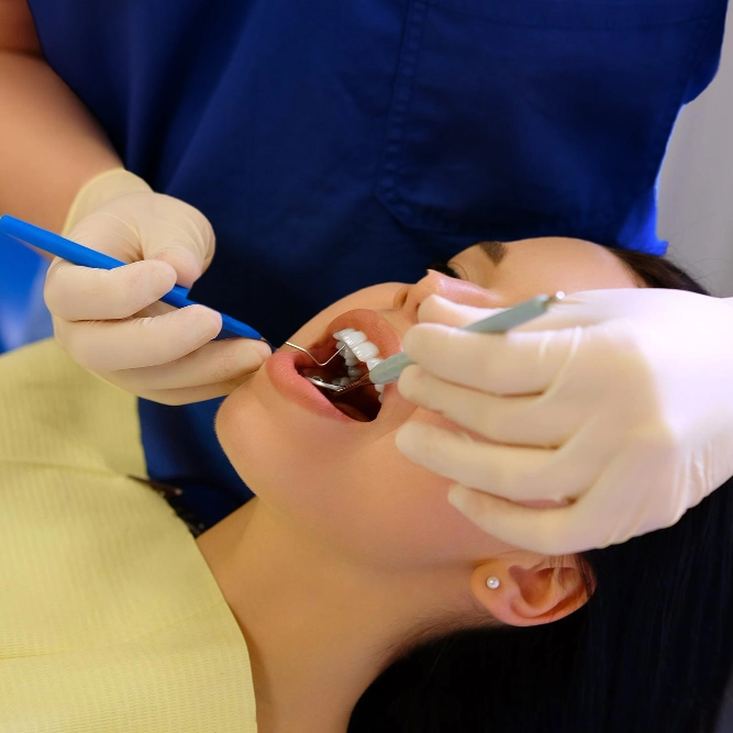 Trám răng 10 Tram rang