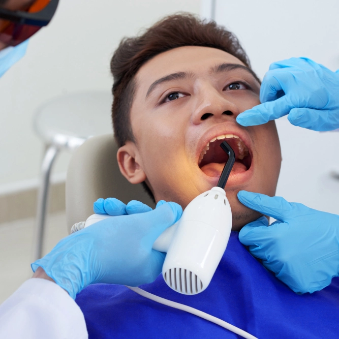 Trám răng 9 Tram rang 299k 1