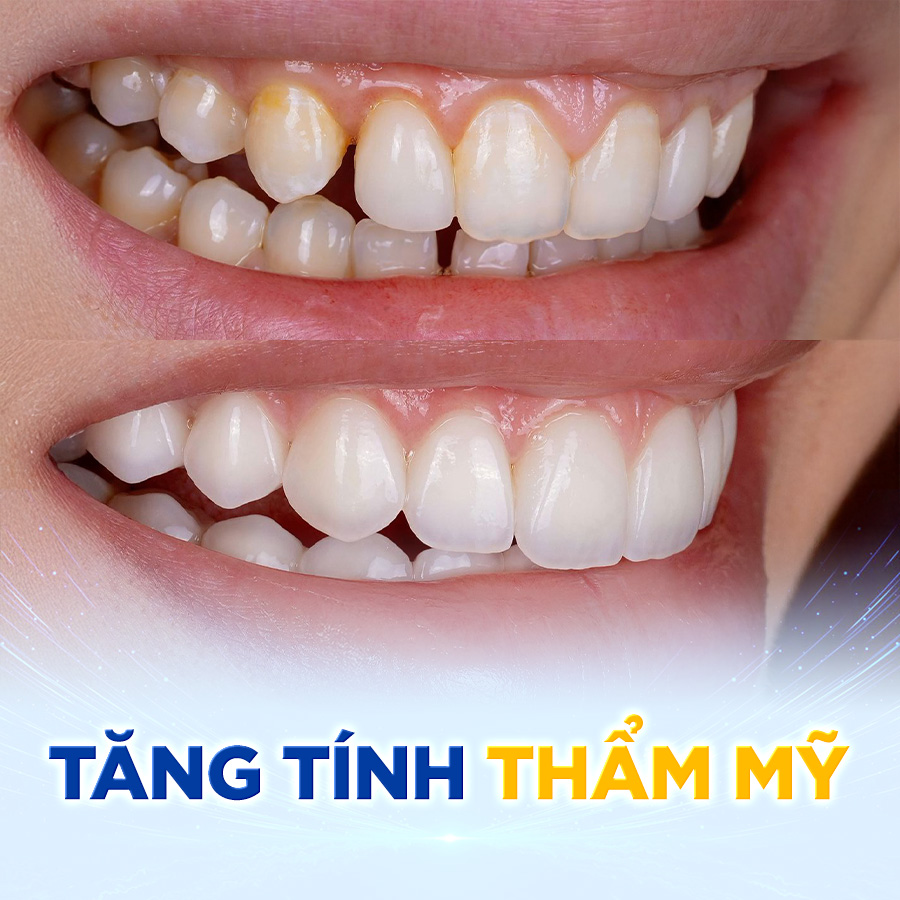 tang tinh tham my