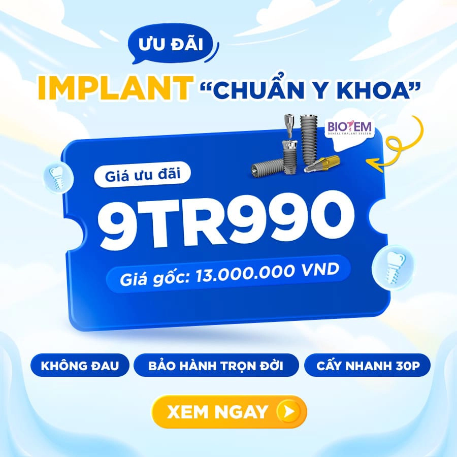 ưu đãi trồng răng 9tr990