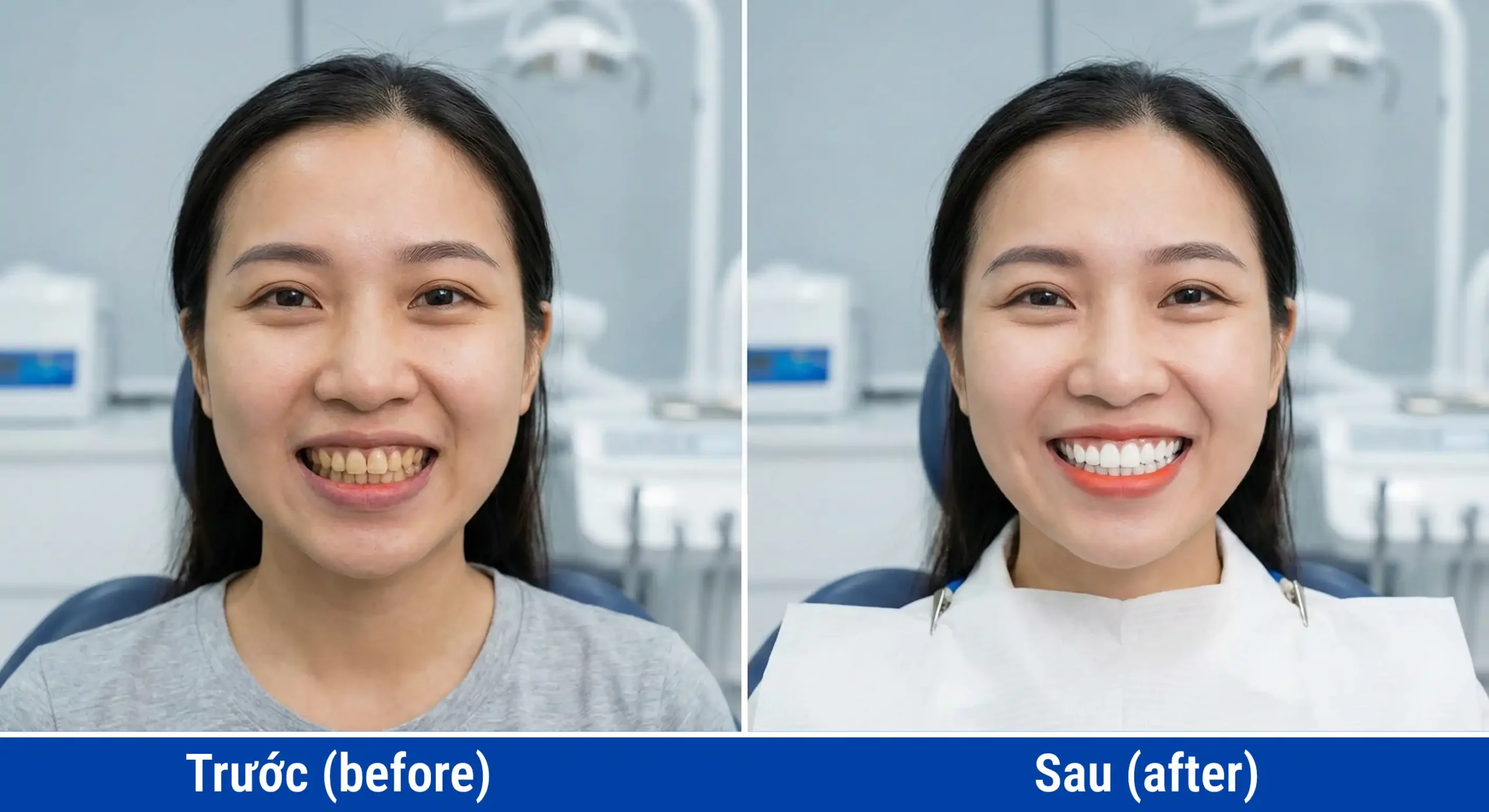 Truoc sau Tay Trang Rang scaled