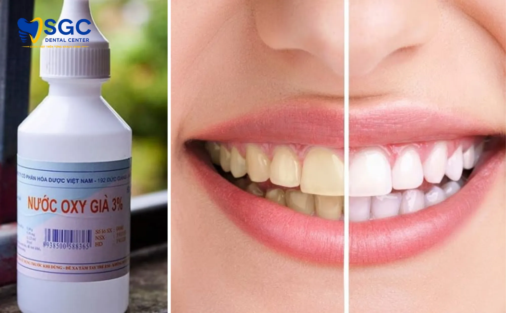 ban-chat-oxy-gia-nha-khoa