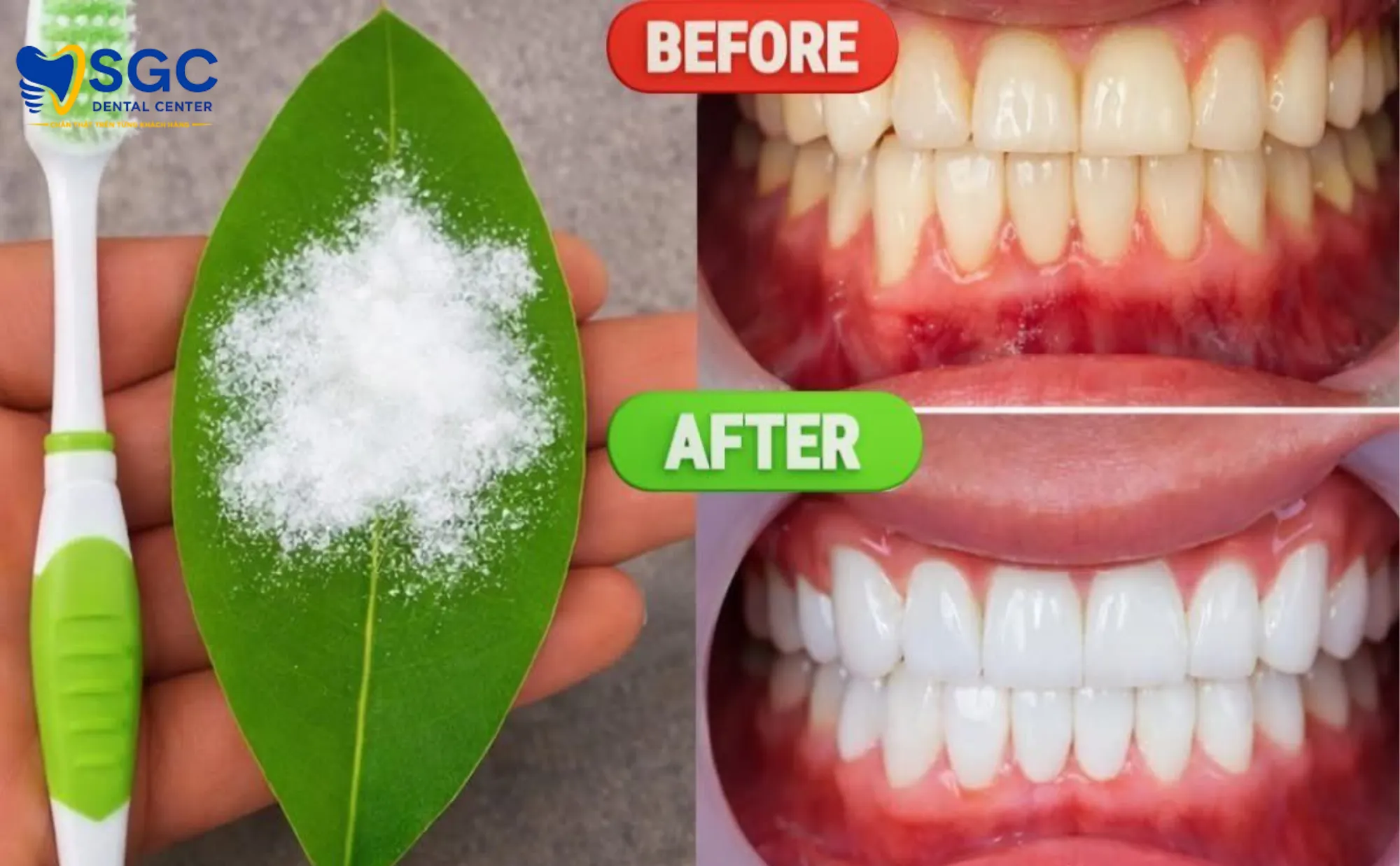 bot-tay-trang-rang-la-gi