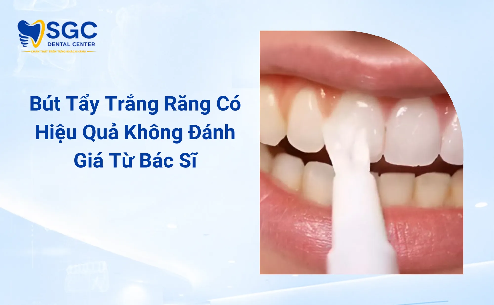 Bút Tẩy Trắng Răng Có Hiệu Quả Không Đánh Giá Từ Bác Sĩ