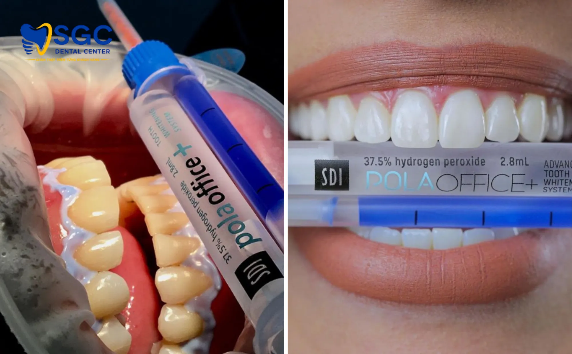 cach-ly-nuou-pola-office