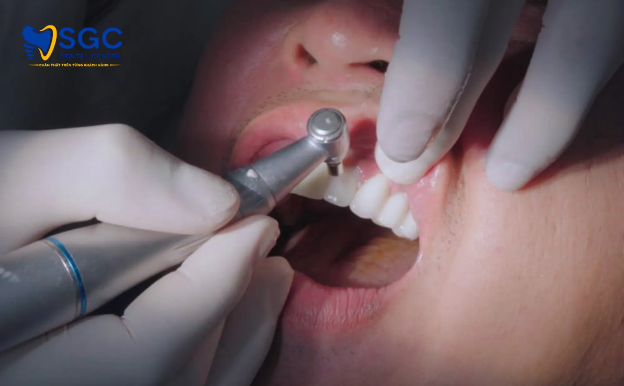 cao-voi-danh-bong-truoc-nieng