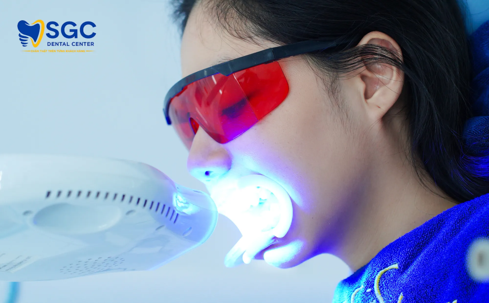 chieu-laser-trang-rang