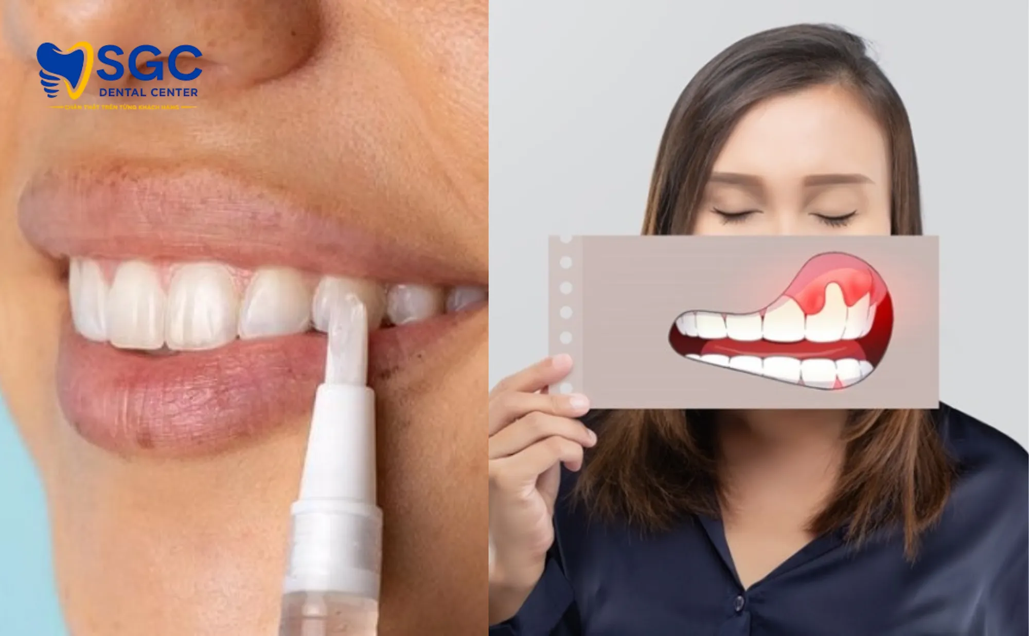 co-che-but-tay-trang-rang