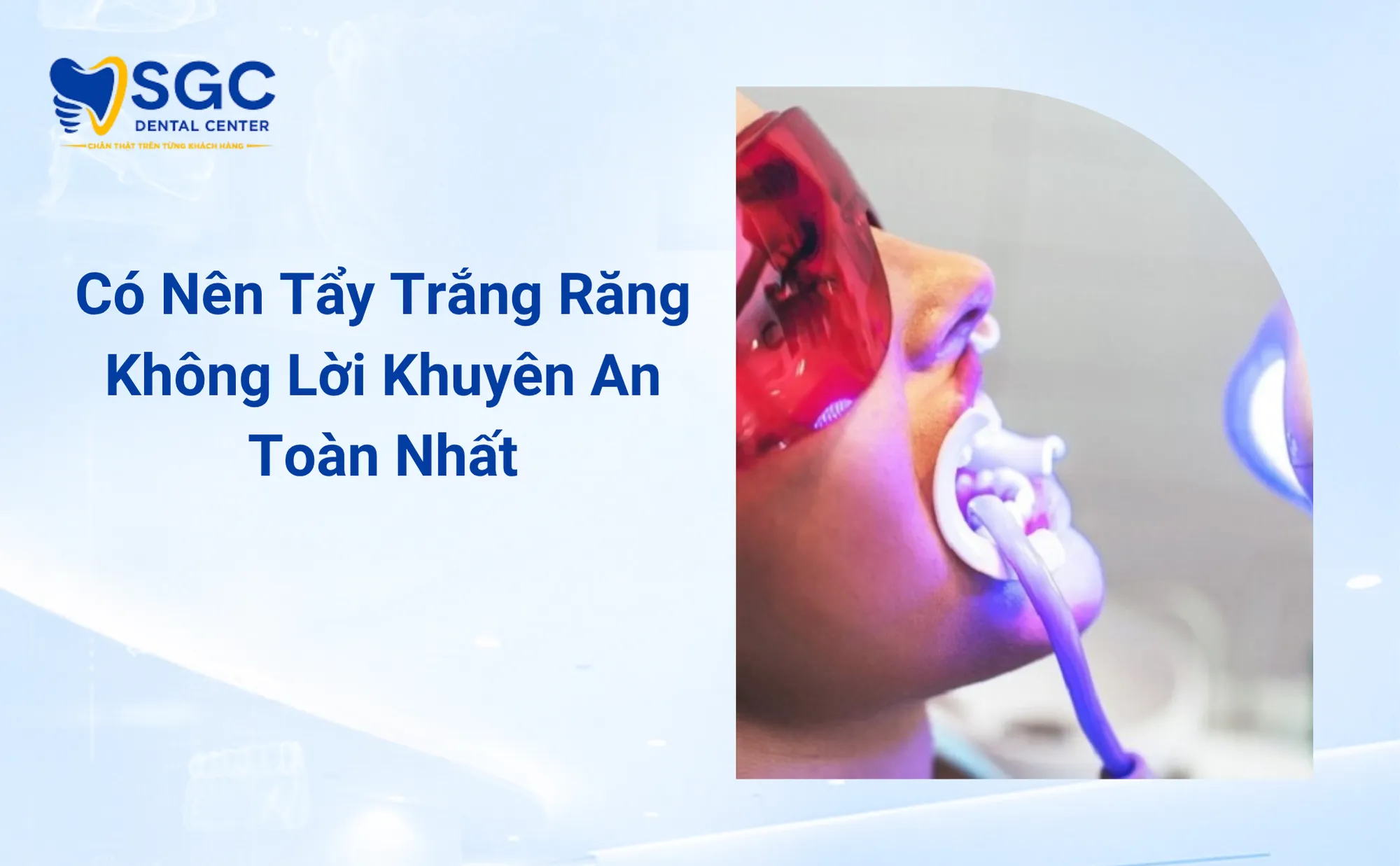 Có Nên Tẩy Trắng Răng Không Lời Khuyên An Toàn Nhất