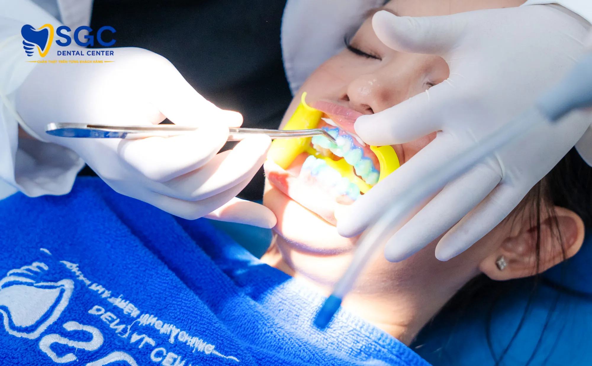 cong-nghe-dual-laser-sgc