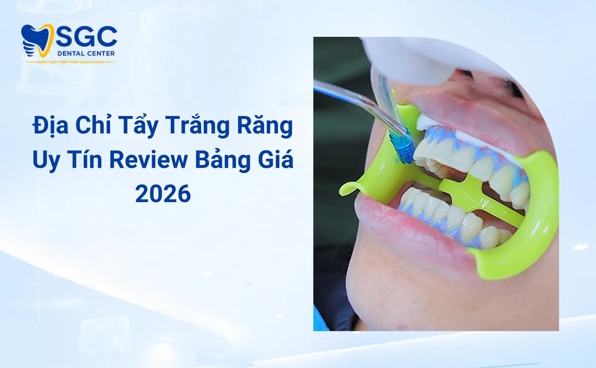 Địa Chỉ Tẩy Trắng Răng Uy Tín Review Bảng Giá 2026