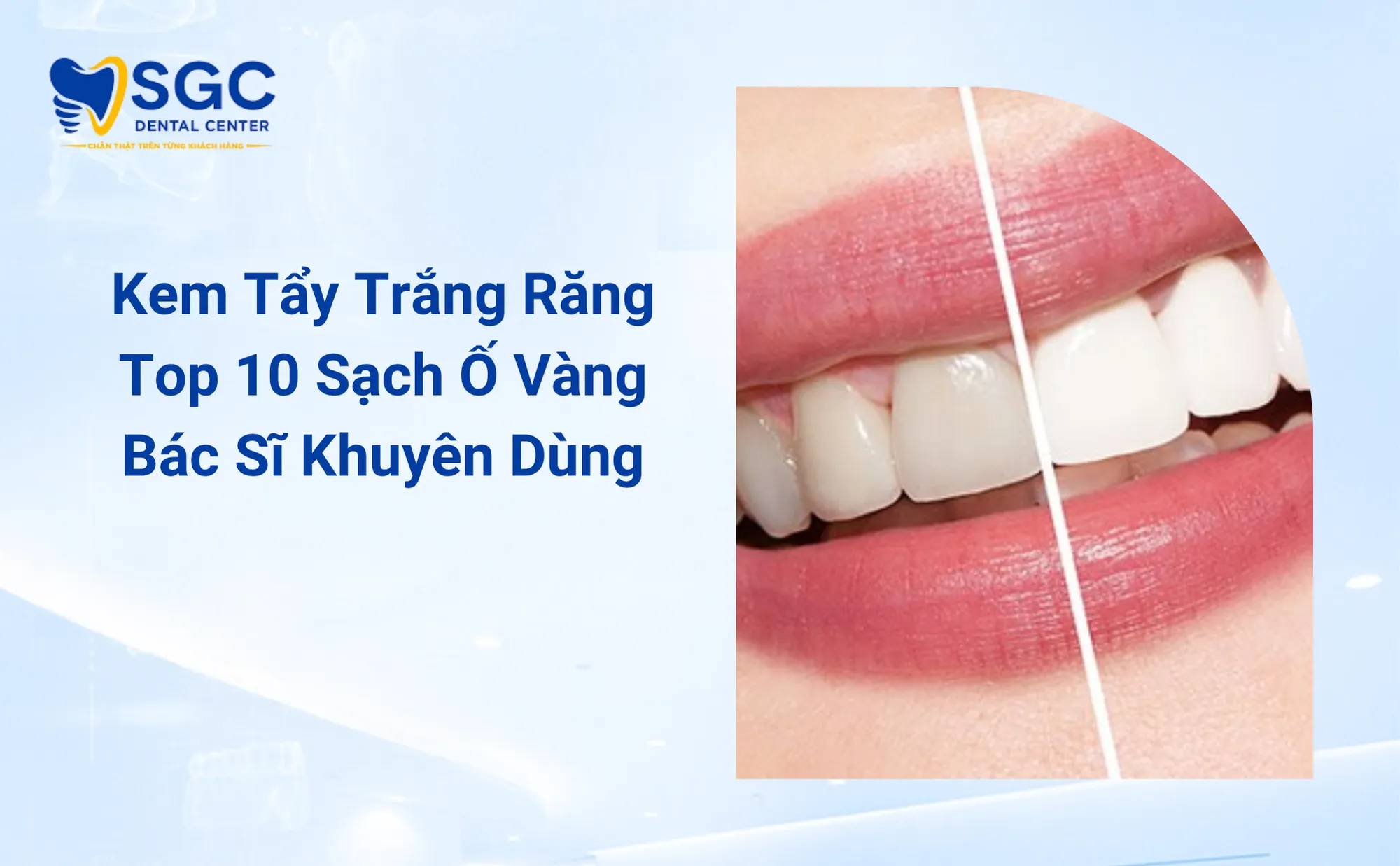 Kem Tẩy Trắng Răng Top 10 Sạch Ố Vàng Bác Sĩ Khuyên Dùng