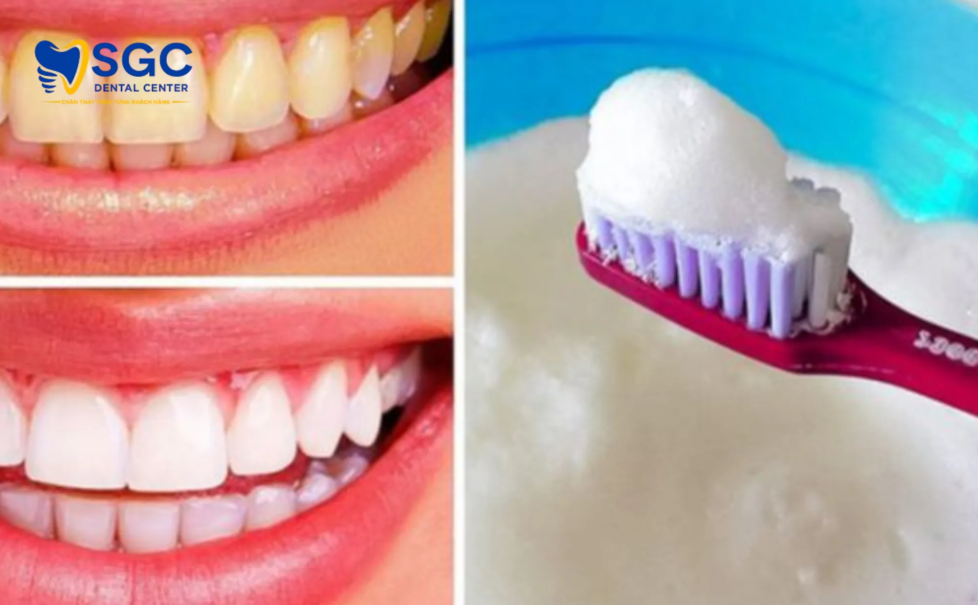 kem-va-thuoc-tay-trang