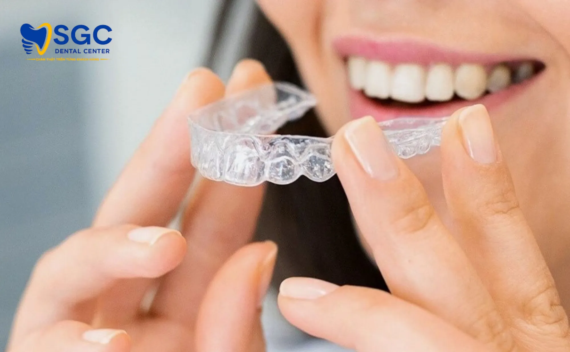 mang-tay-trang-rang-ca-nhan-hoa