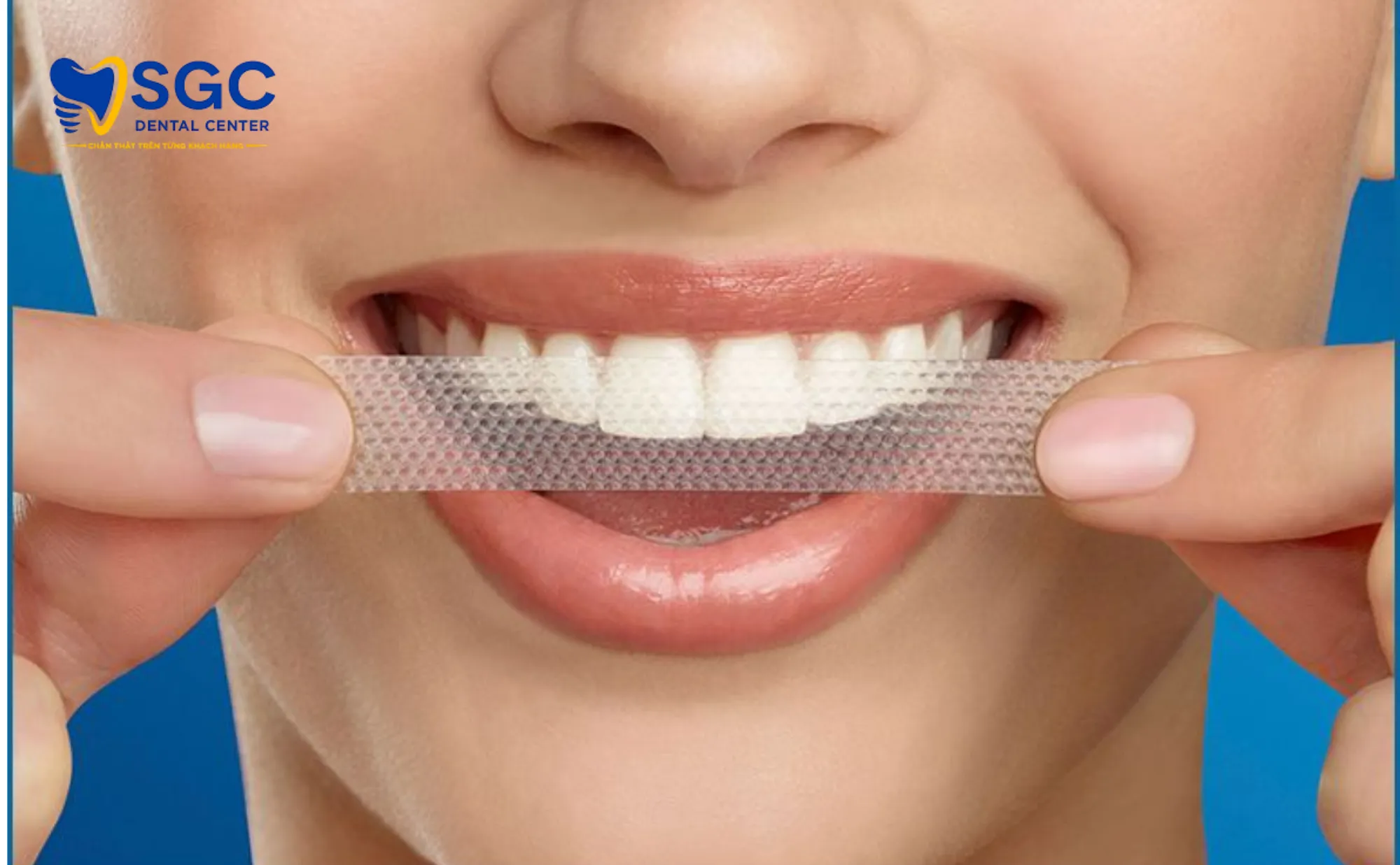 mieng-dan-trang-rang-la-gi