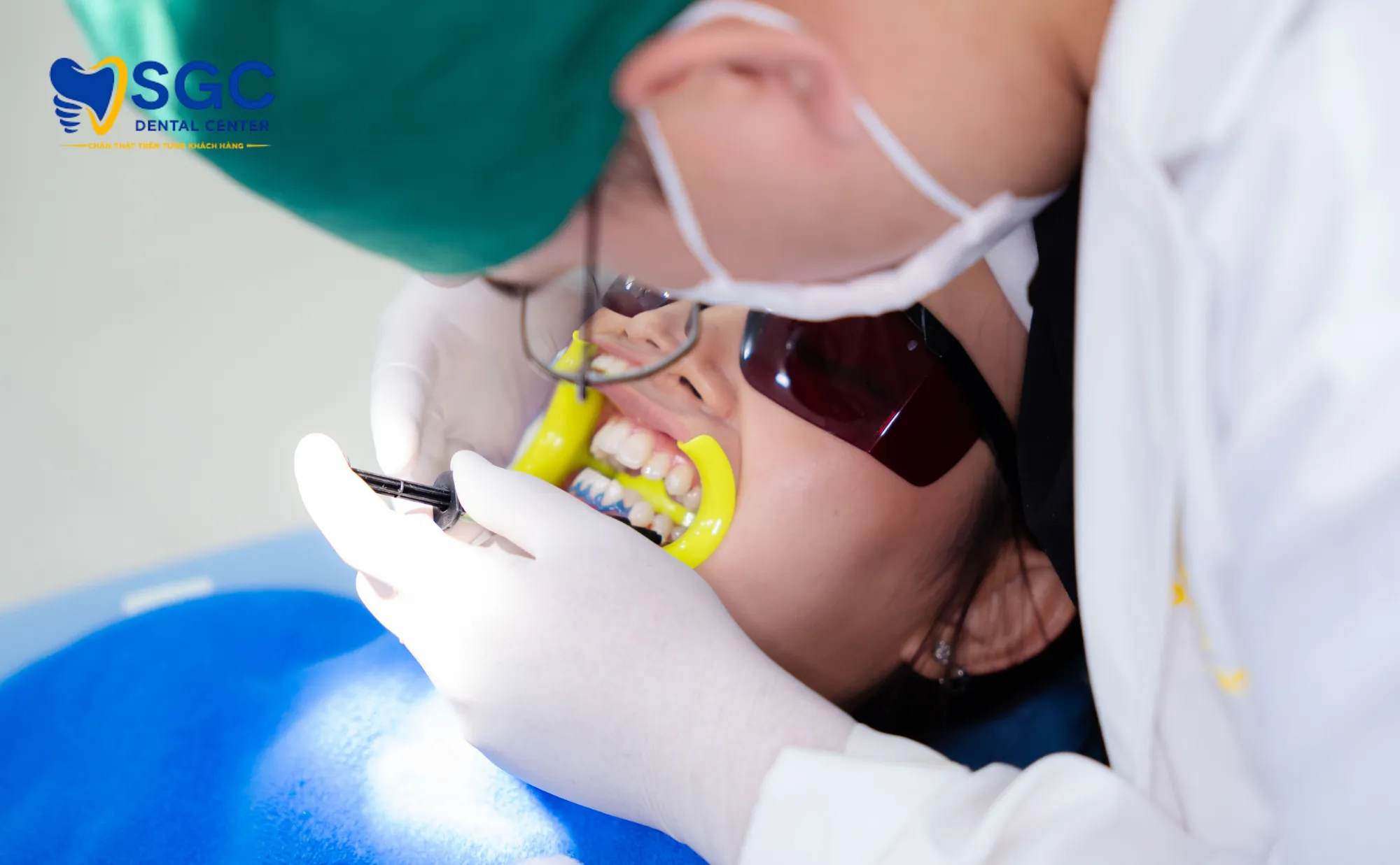 quy-trinh-tay-trang-rang-laser