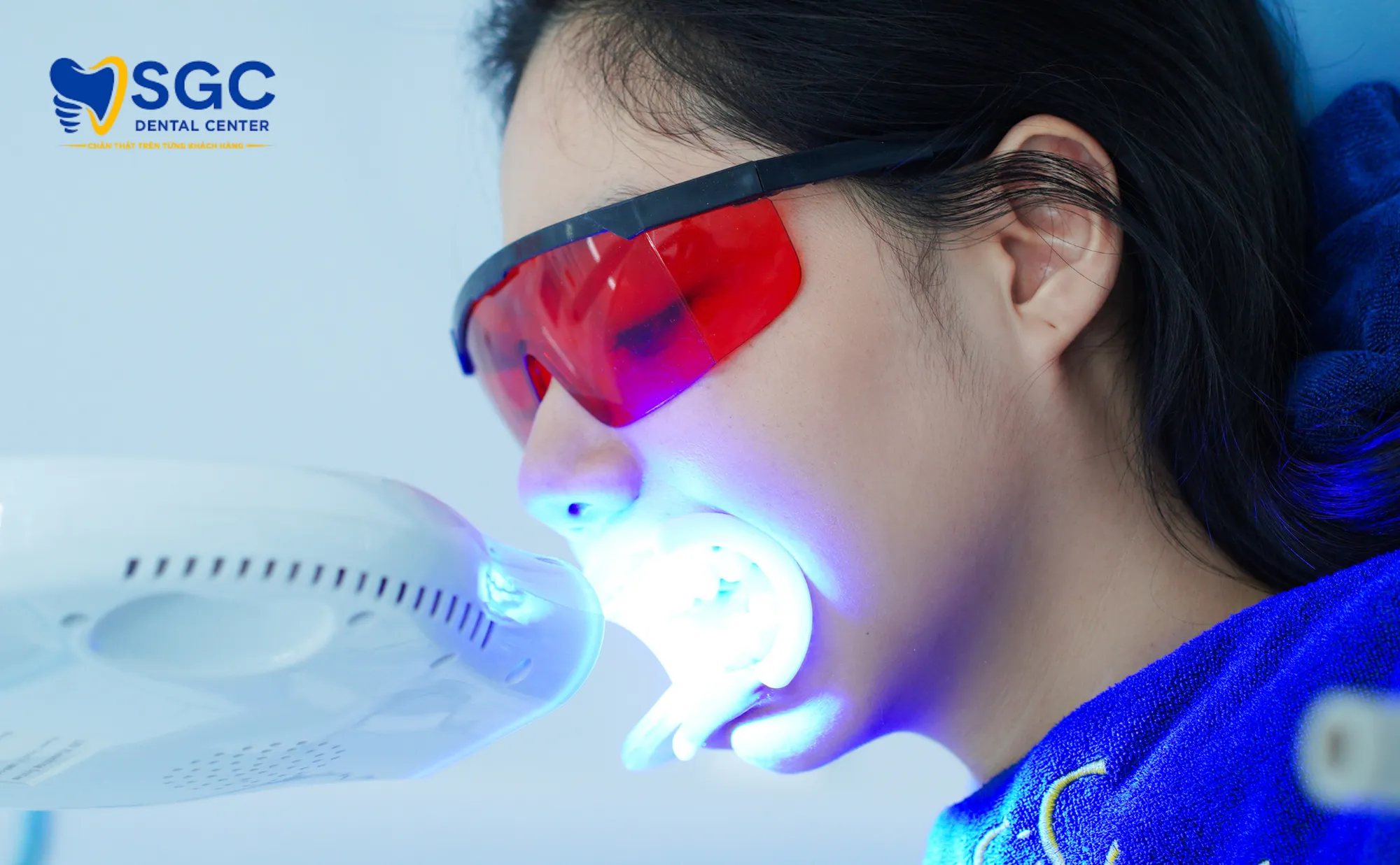 quy-trinh-tay-trang-rang-sgc