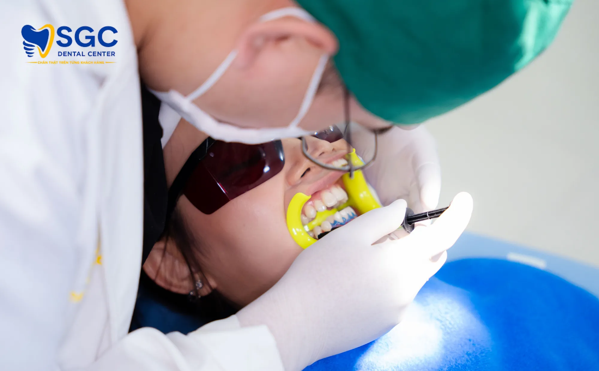 quy-trinh-tay-trang-sgc