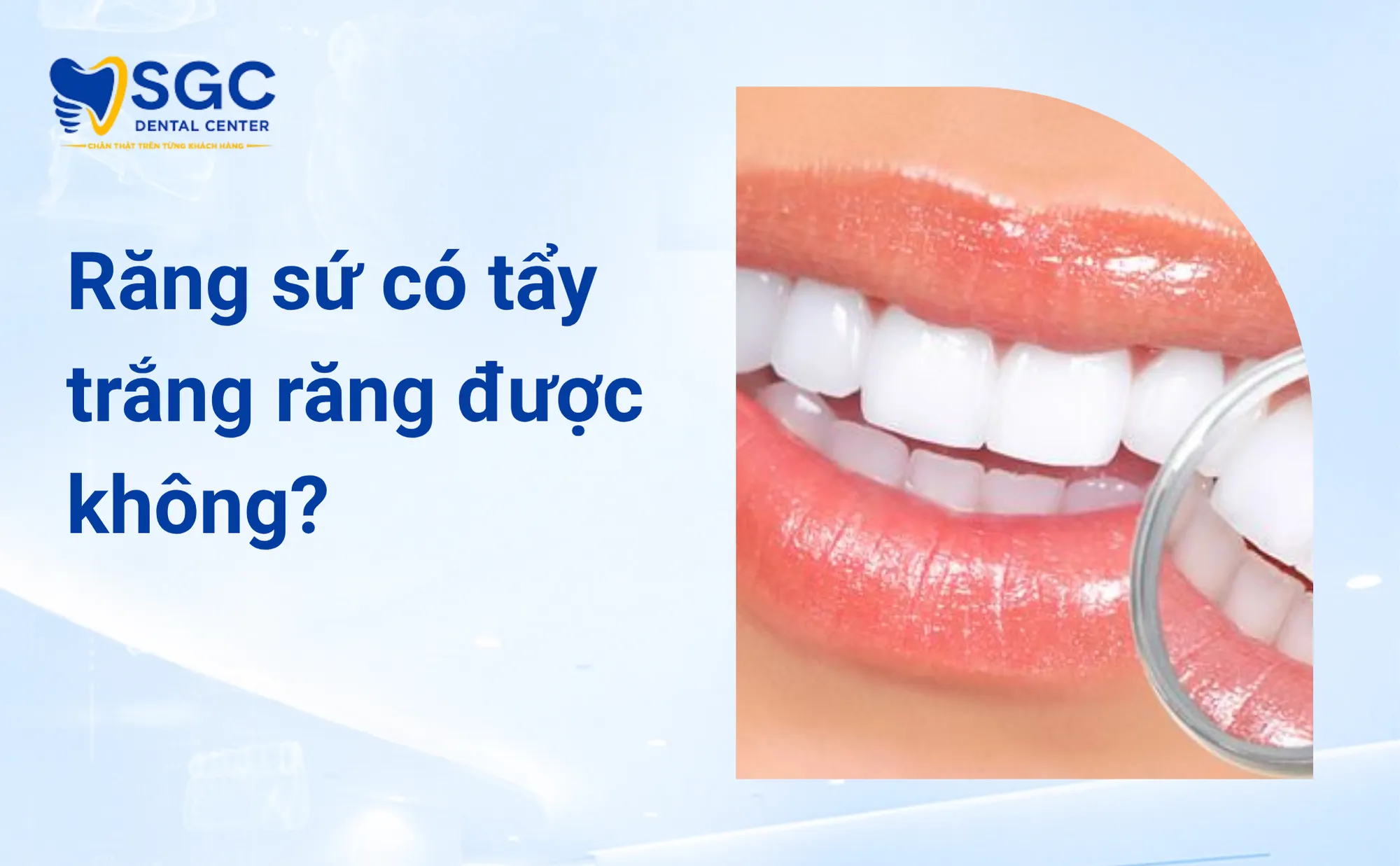 Răng Sứ Có Tẩy Trắng Được Không Sự Thật Y Khoa Cần Biết