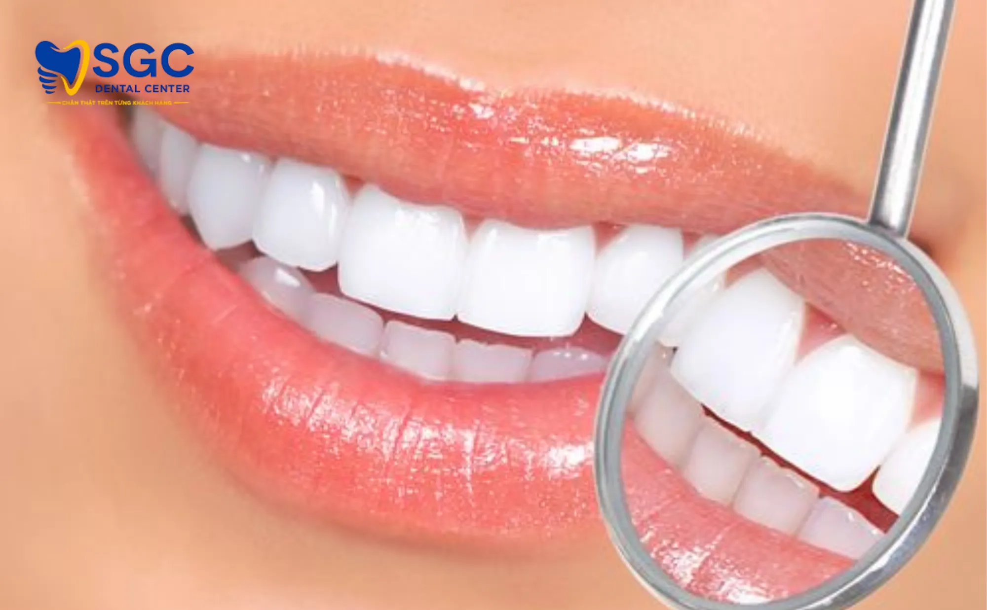 rang-su-khong-tay-trang