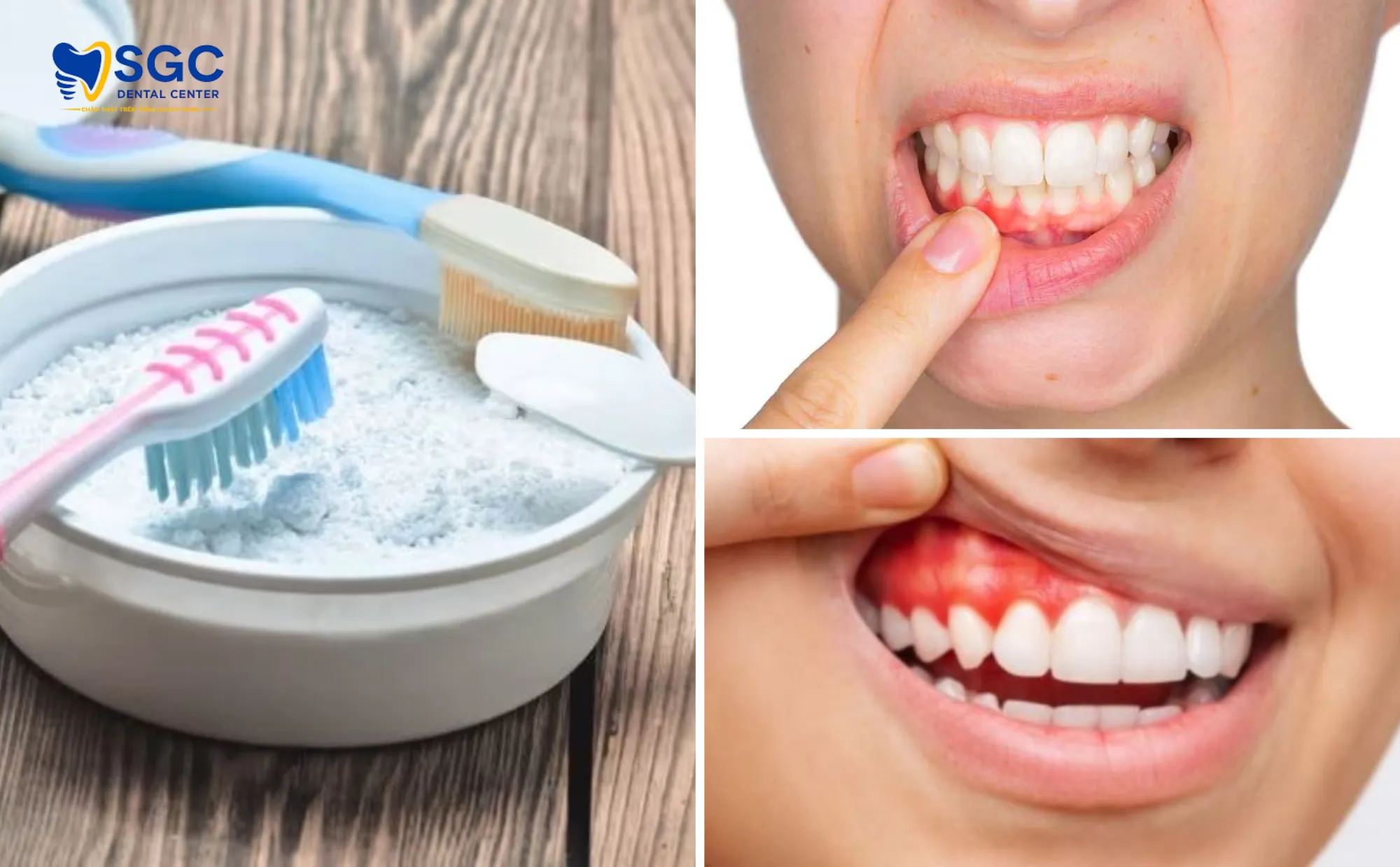 review-bot-tay-trang-rang