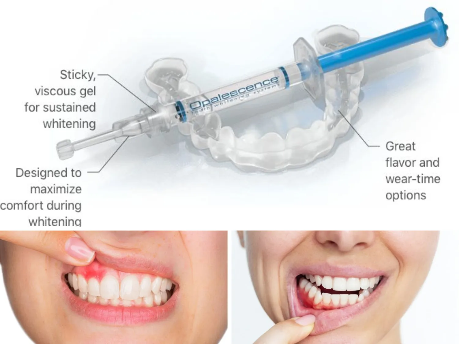 rui-ro-khay-nhua-opalescence.wepd
