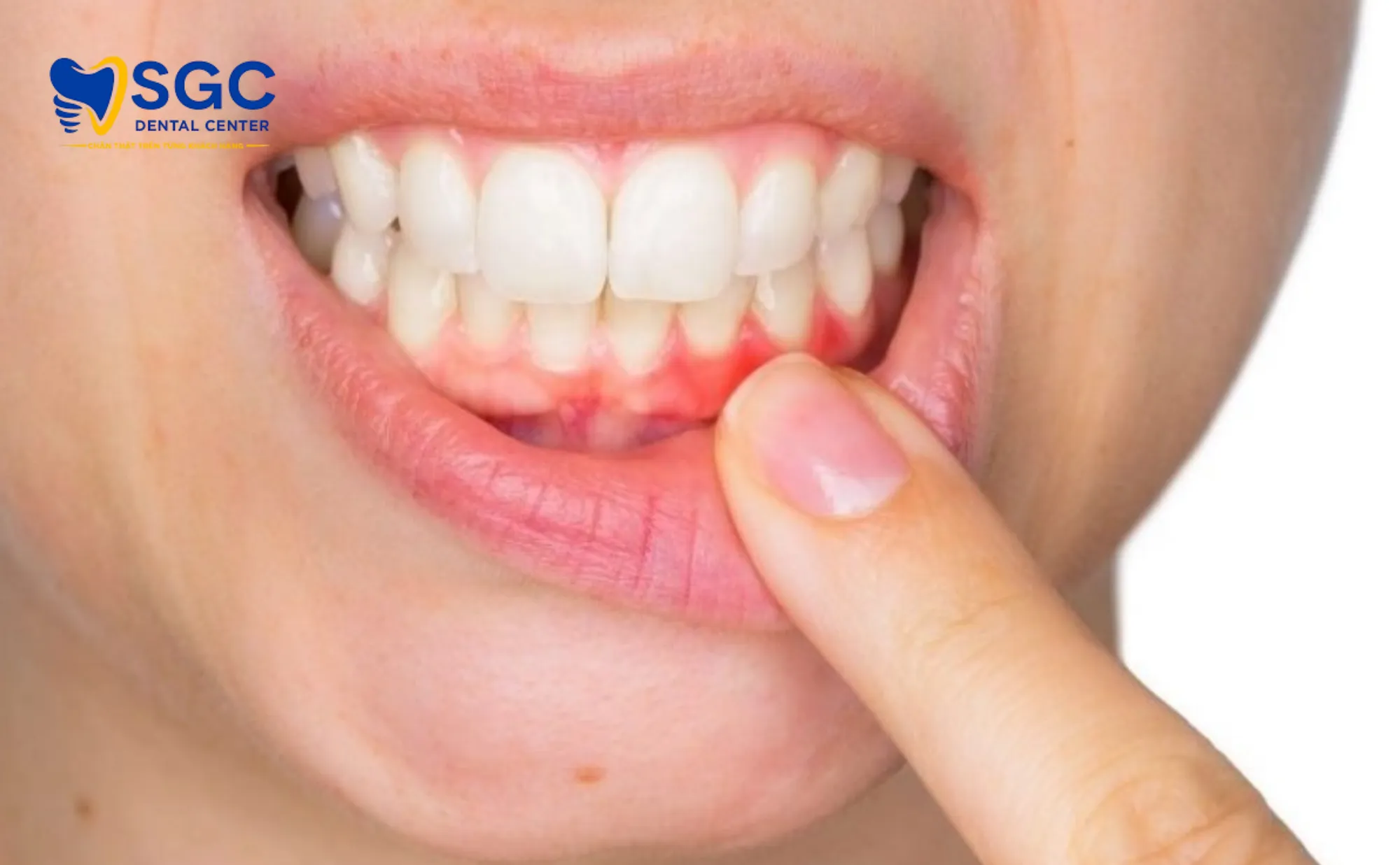 rui-ro-khay-silicon-lam-san