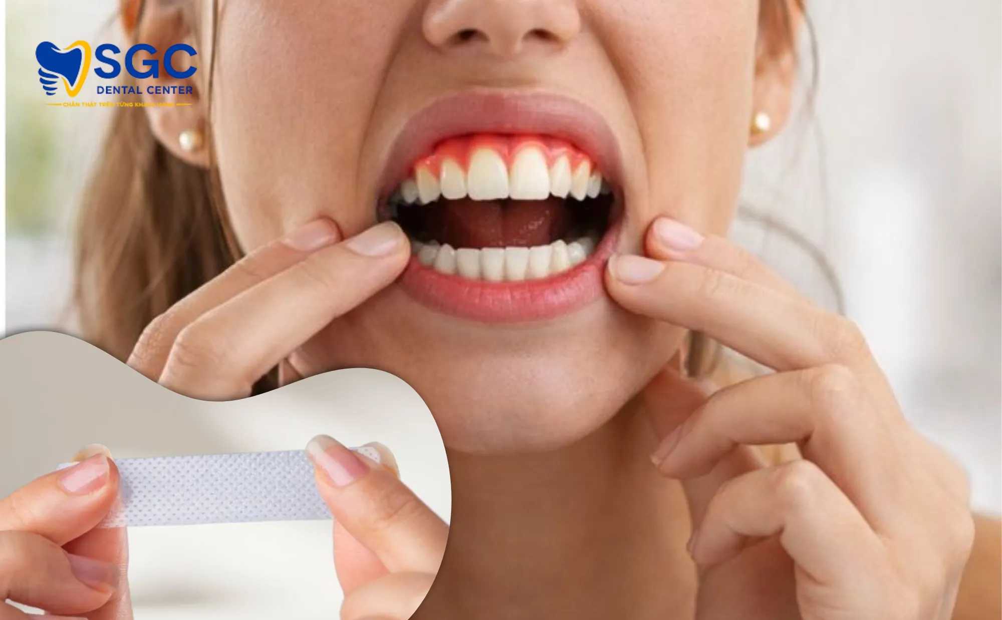 tac-hai-mieng-dan-trang-rang