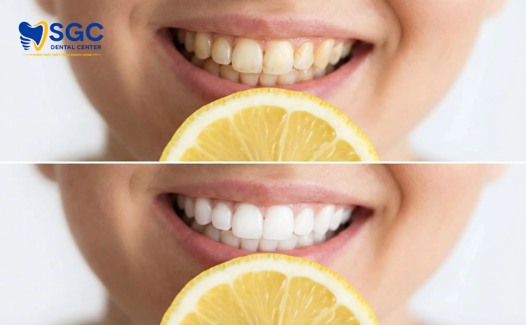 tac-hai-tay-rang-bang-chanh