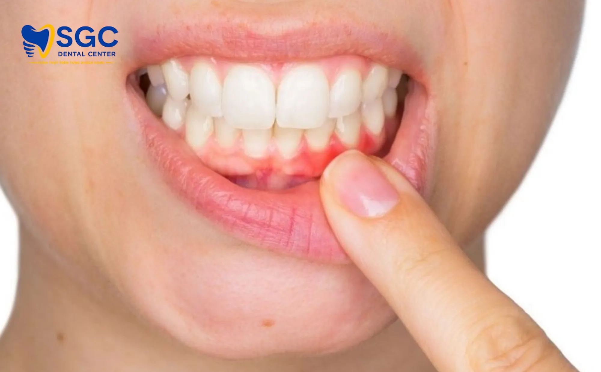 tac-hai-tay-trang-rang-sai-cach