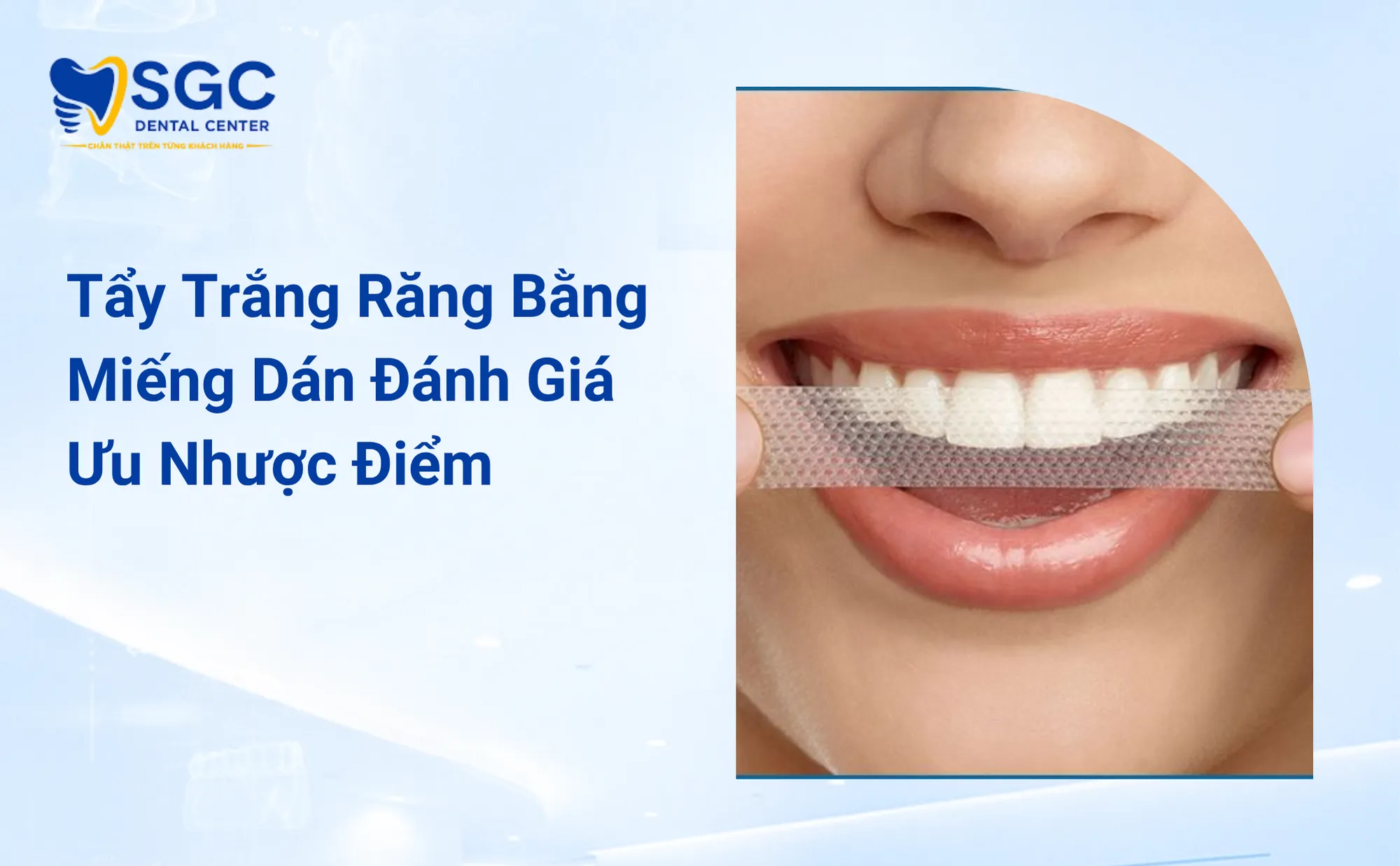 Tẩy Trắng Răng Bằng Miếng Dán Đánh Giá Ưu Nhược Điểm