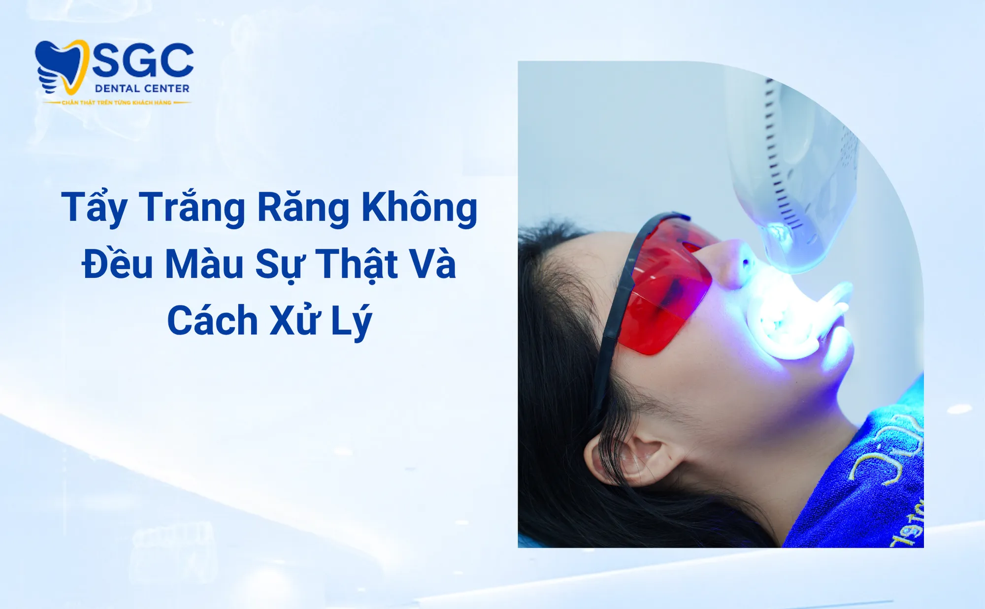 Tẩy Trắng Răng Không Đều Màu Sự Thật Và Cách Xử Lý