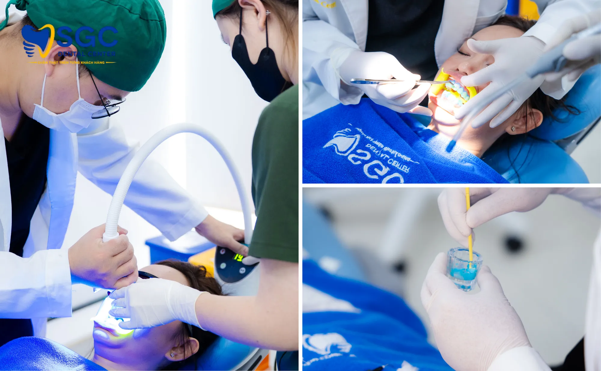 tay-trang-rang-laser