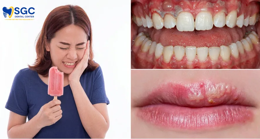 Tẩy trắng răng bị ê buốt bao lâu thì hết và cách giảm đau