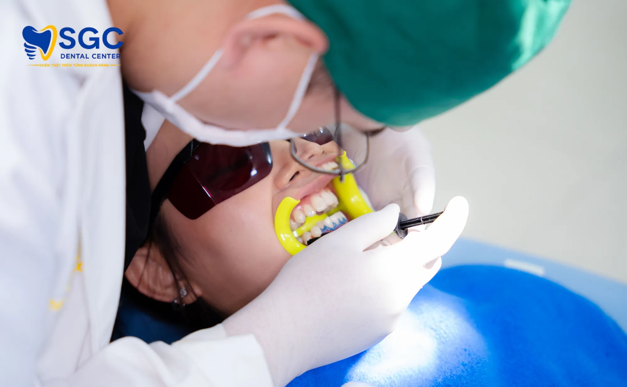 top-thuoc-tay-trang-trang-rang-nha-khoa