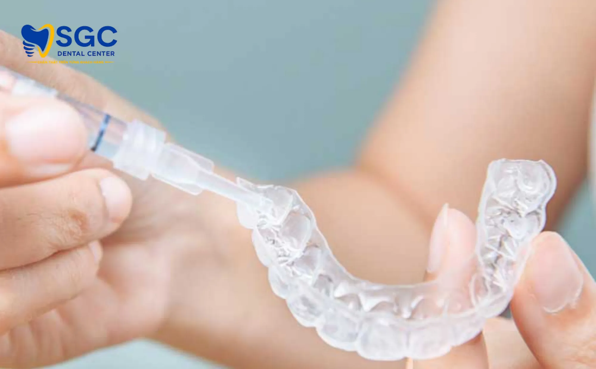 ve-sinh-mang-tay-trang-rang