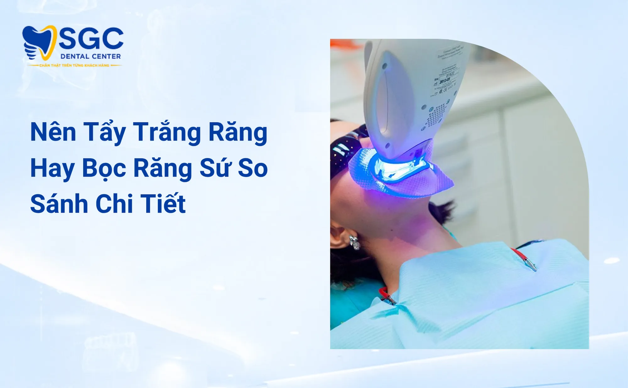 Nên Tẩy Trắng Răng Hay Bọc Răng Sứ So Sánh Chi Tiết