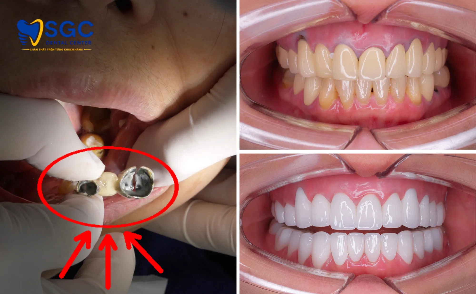 thay-mao-su-moi-an-toan