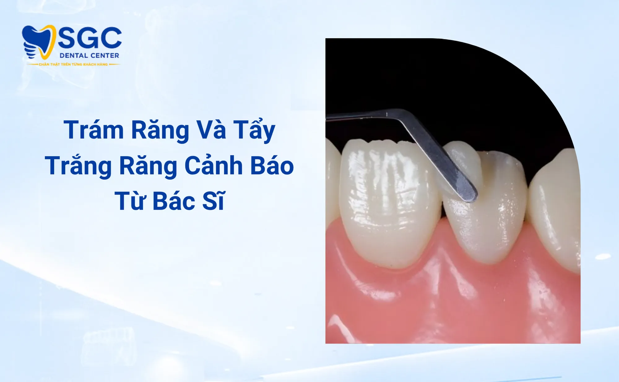 Trám Răng Và Tẩy Trắng Răng Cảnh Báo Từ Bác Sĩ